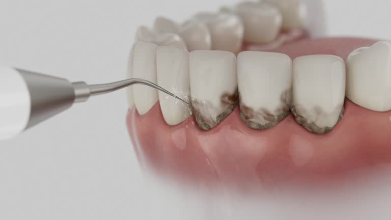 Trusted Teeth Cleaning And Checkup service in Springfield, CO - Dentist Open Now